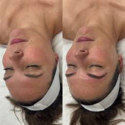 Detox Gua Sha Facial in Parker CO by Beauty Refined