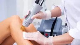 Laser Hair Removal Treatment by Beauty Refined in Parker, CO