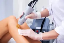 Laser Hair Removal Treatment by Beauty Refined in Parker, CO