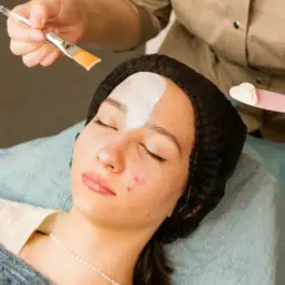 Refined Teen Facial in Parker CO by Beauty Refined